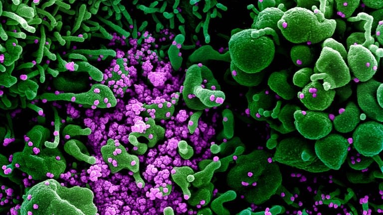Auf dieser vom US-Forschungszentrum «National Institute of Allergy and Infectious Diseases» (NIAID) zur Verfügung gestellten Aufnahme vom 13.02.2020 ist eine Zelle (grün) mit dem Coronavirus (SARS-CoV-2, violett) infiziert. Die Probe wurde von einem Patienten in den USA isoliert.