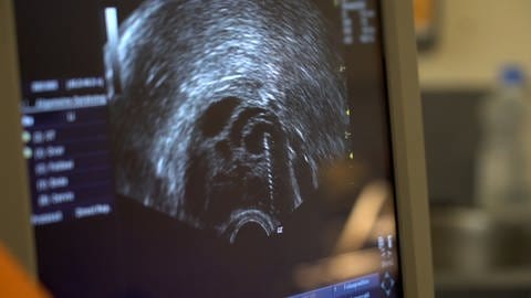 Mit Ultraschall zu sehen: Für eine Eizellspende werden Frauen wie bei einer künstlichen Befruchtung in Kinderwunsch-Zentren in Deutschland hormonell stimuliert, sodass sie mehrere Eizellen bilden. (Foto: SWR)