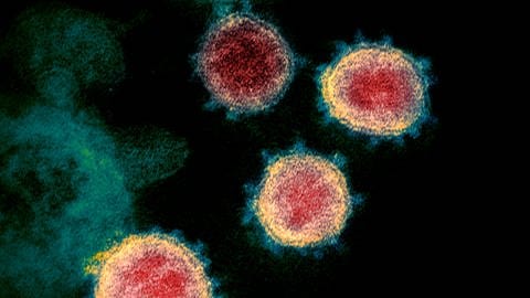 Das Virus Covid-19 in einer nachcolorierten Aufnahme eines Elektronenmikroskops, gut sichtbar sind die feinen Noppen, welche den Körper des Virus umgeben (Foto: IMAGO, imago images/ZUMA Wire)
