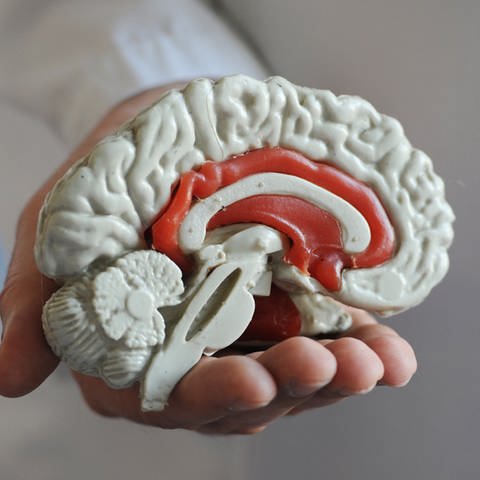Das Modell von einem menschlichen Gehirn (Symbolbild)