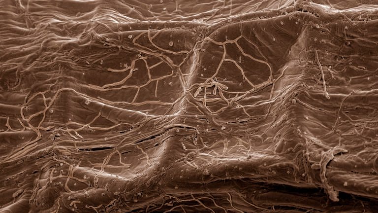 Mykoorrhizapilz an Pflanzenwurzel