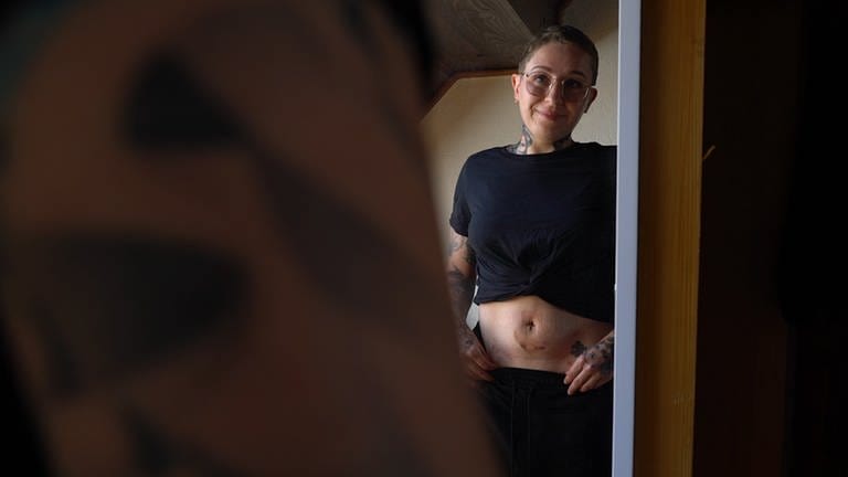 Junge Frau vor Spiegel mit OP-Narbe (Foto: SWR, Nur im redaktionellen Kontext des Ursprungsbeitrags verwenden)