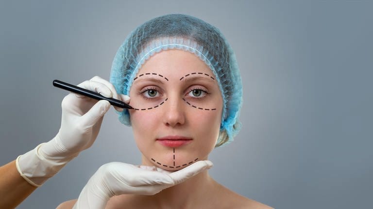 Schönheitschirurg zeichnet vor der Behandlung Linien auf dem Gesicht einer Frau (Foto: picture-alliance / Reportdienste, picture alliance / Zoonar | Jakub Mrocek)