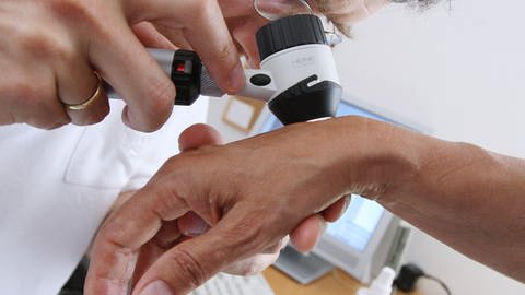 Ein Hautarzt untersucht in seiner Praxis mit einem Vergrößerungsglas die Haut einer Patientin bei einer Hautkrebs-Früherkennung. 