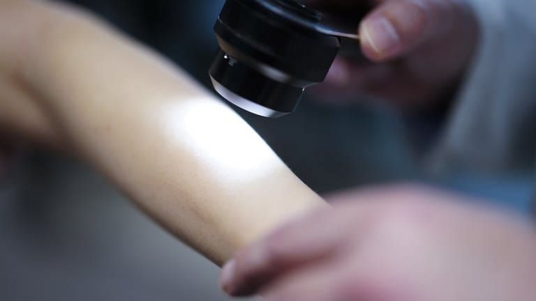 Ein Hautarzt untersucht bei einer Krebsvorsorgeuntersuchung eine Patientin mit einem Auflichtmikroskop. (Foto: picture-alliance / Reportdienste, dpa Bildfunk, picture alliance / dpa / APA | Eva Manhart)