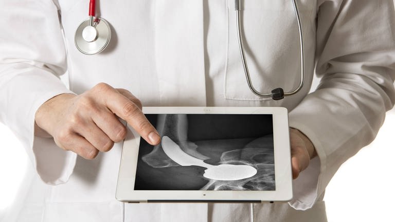 Ärztin mit einer Röntgenaufnahme eines künstlichen Hüftgelenks (Foto: IMAGO, Jochen Tack)
