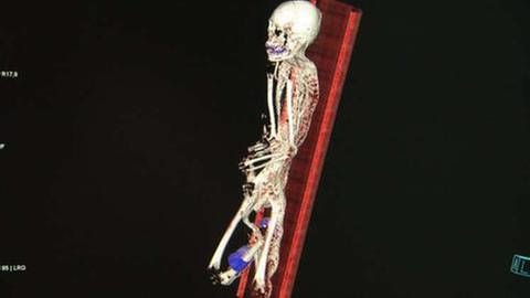 Auch kleinste Verletzungen sind im 3-dimensionalen Abbild der Mumie zu erkennen (Foto: SWR, SWR - Thomas Hillebrandt)