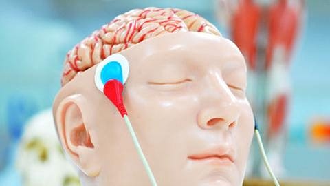Elektroden kleben an einer Anatomie-Nachbildung des menschlichen Kopfes mit geöffneter Schädeldecke. (Foto: Colourbox, Foto: Colourbox.de -)