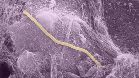 Krank machende Bakterien siedeln in den Zellen der Blasenwand (Foto: picture-alliance / dpa, picture-alliance / dpa -)