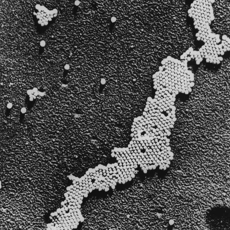Das Poliomyelitis-Virus, die Ursache der Kinderlähmung, wurde 1908 von Karl Landsteiner entdeckt. Der Impfstoff gegen Polio wurde zwischen 1948 und 1953 entwickelt. (Foto: IMAGO, IMAGO / Everett Collection)