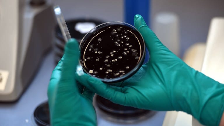 Eine Mitarbeiterin hält in einem Speziallabor des Landesumweltamtes eine Petrischale mit Proben von Legionellen. (Foto: dpa Bildfunk, picture alliance/dpa | Federico Gambarini)