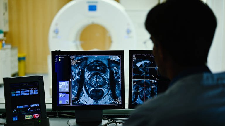Ein Mitarbeiter betrachtet in einem Kontrollraum des Deutschen Krebsforschungszentrum (DKFZ) auf einem Monitor das Querschnittsbild einer Prostata. (Foto: dpa Bildfunk, picture alliance/dpa/Uwe Anspach)