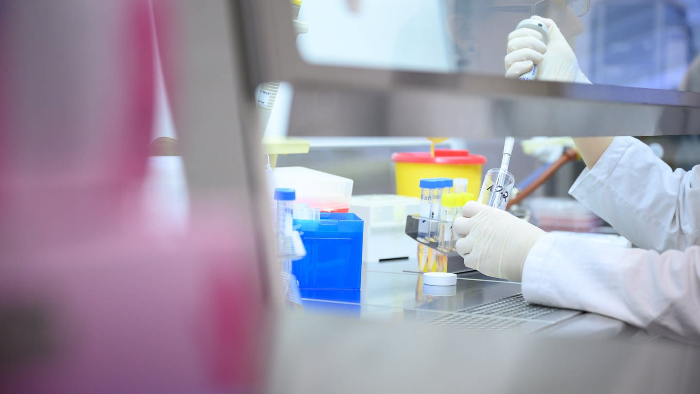 Eine Frau zeigt in einem Labor einen Test für das neue Virus 2019-nCov (Archivbild).