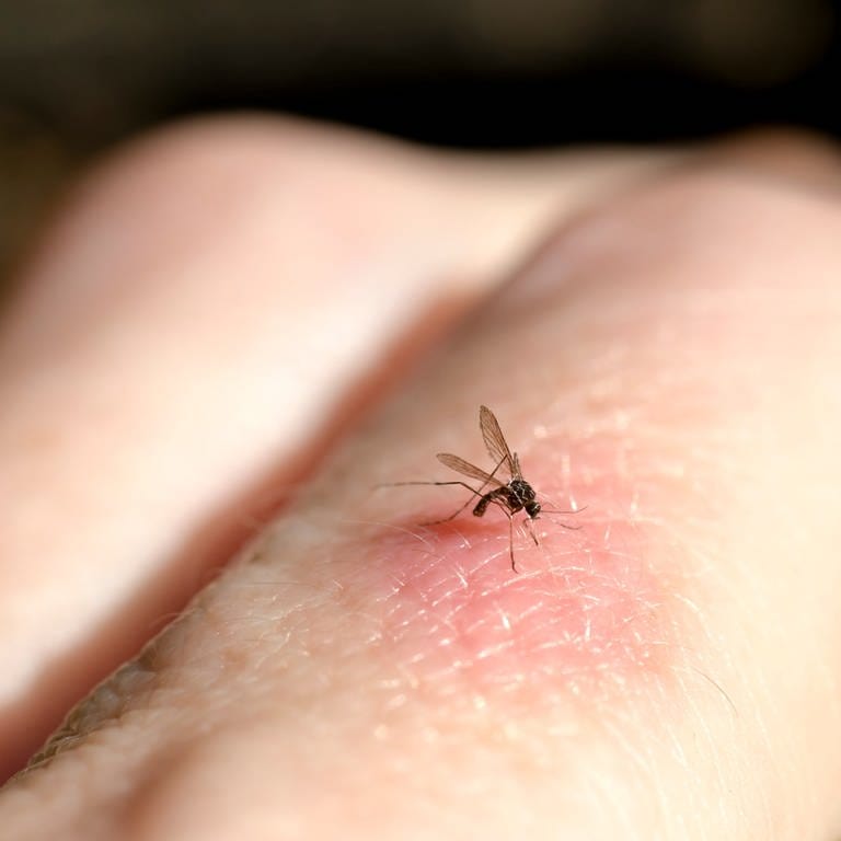 Insektenstich - Mücke sticht in Finger (Foto: SWR)