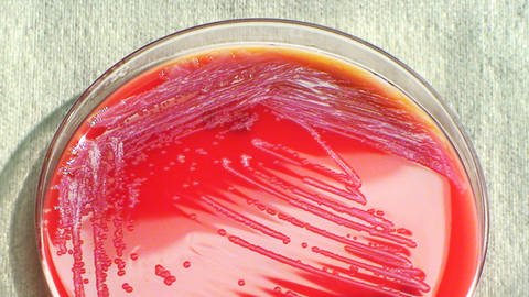 In einer roten Petrischale werden die Bakterien Serratia marcescens gezüchtet. (Foto: dpa Bildfunk, Picture Alliance)