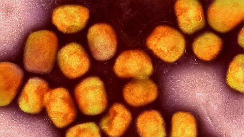 Eine kolorierte elektronenmikroskopische Aufnahme von Partikeln des Affenpockenvirus (Foto: dpa Bildfunk, picture alliance/dpa/Planet Pix via ZUMA Press Wire | Niaid/Niaid)