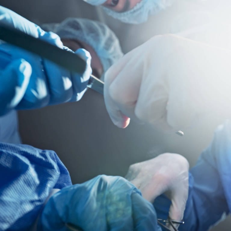 Symbolbild: Ärzte während einer Operation mit Skalpell in der Hand