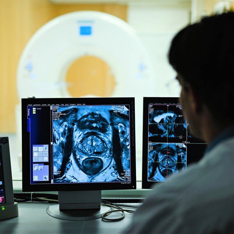 Ein Mitarbeiter betrachtet in einem Kontrollraum des Deutschen Krebsforschungszentrum (DKFZ) auf einem Monitor das Querschnittsbild einer Prostata. (Foto: picture-alliance / Reportdienste, picture alliance/dpa | Uwe Anspach)