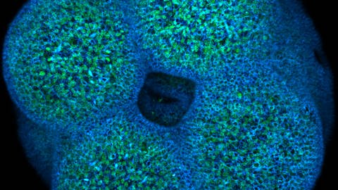 Zellteilung einer Seeanemone (Foto: Europäisches Laboratorium für Molekularbiologie)