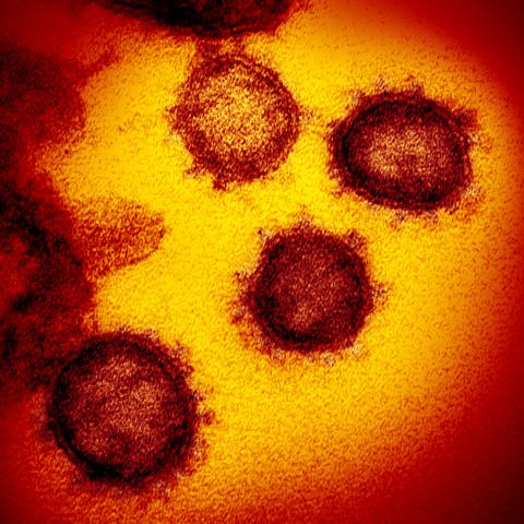  Eine undatierte elektronenmikroskopische Aufnahme des «U.S. National Institute of Health» zeigt das neuartige Coronavirus (SARS-CoV-2). (Foto: dpa Bildfunk, picture alliance/---/NIAID-RML/AP/dpa)