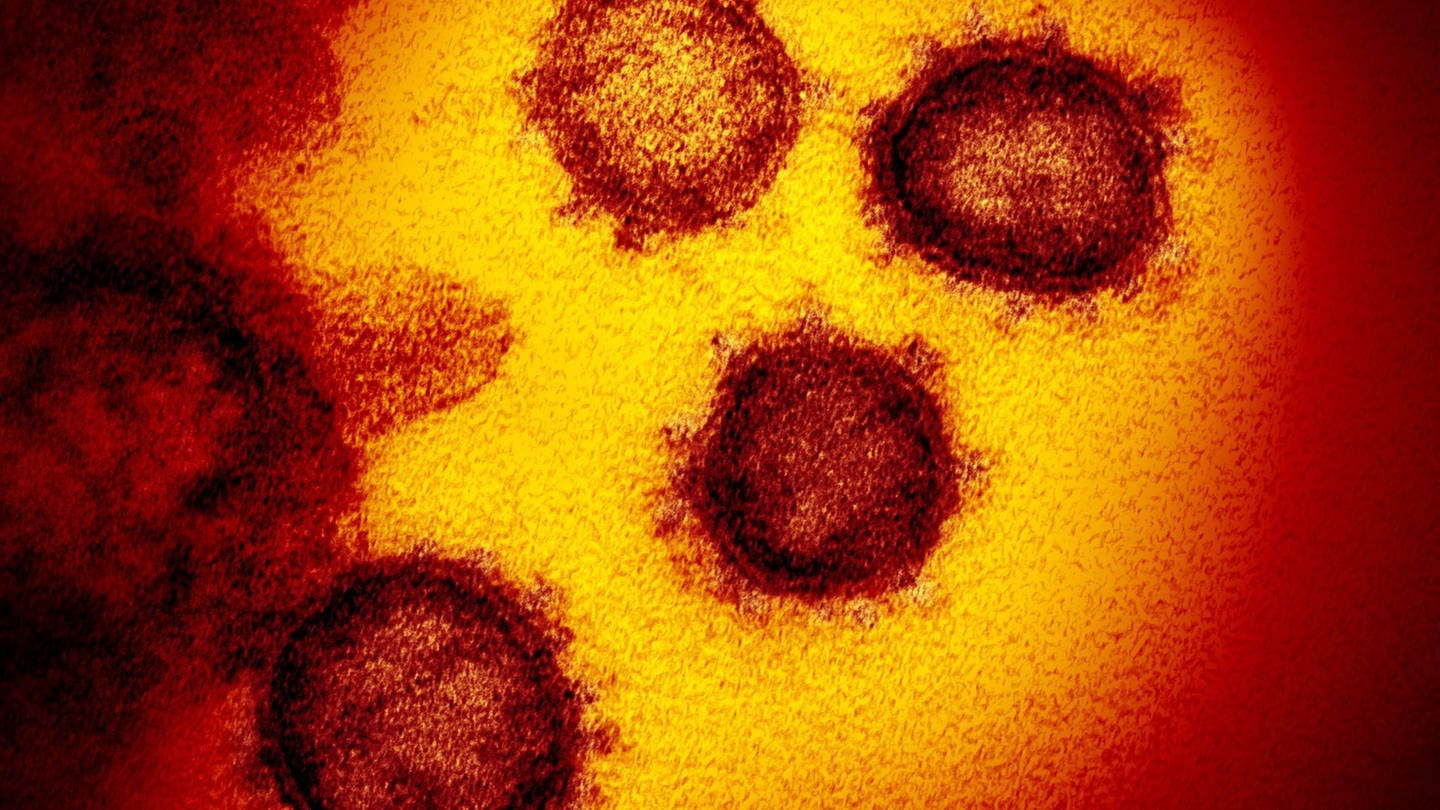 Eine undatierte elektronenmikroskopische Aufnahme des «U.S. National Institute of Health» zeigt das neuartige Coronavirus (SARS-CoV-2). (Foto: dpa Bildfunk, picture alliance/---/NIAID-RML/AP/dpa)
