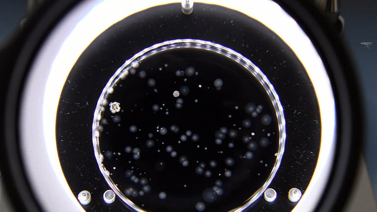 Eine Petrischalen mit Proben von Legionellen steht 2016 in Düsseldorf unter einer Lupe (Symbolbild). (Foto: dpa Bildfunk, picture alliance / dpa | Federico Gambarini)