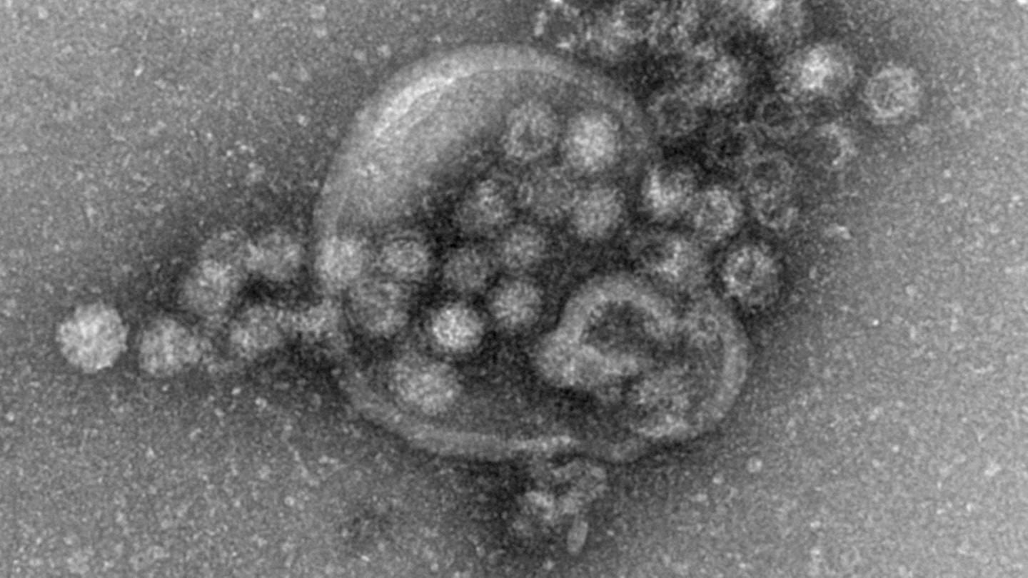 FAQ: Das sollte man zum Norovirus und zum Frühlingsfest wissen
