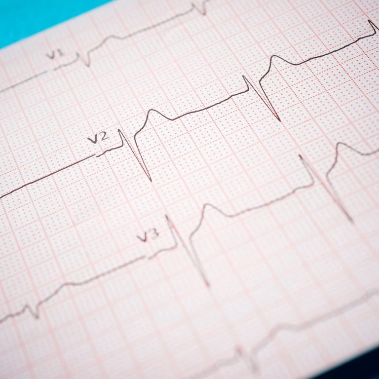 Elektrokardiogramm (EKG) (Foto: IMAGO, Cavan Images)