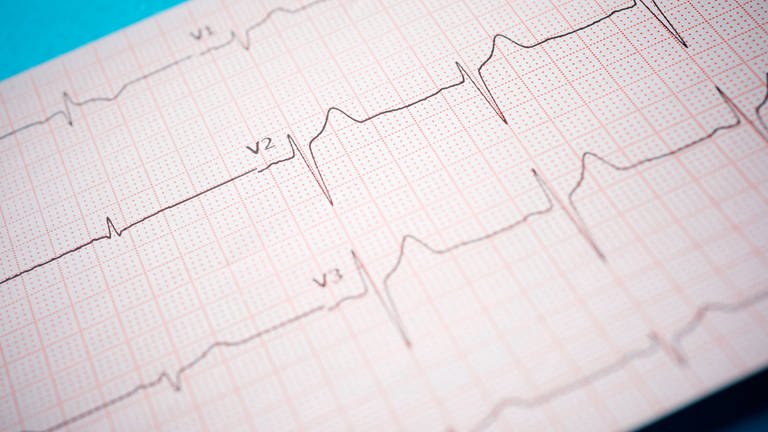 Elektrokardiogramm (EKG)