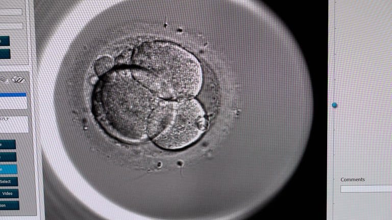 Eine befruchtete Eizelle entwickelt sich im Labor einer Kinderwunsch-Praxis zu einem Embryo. Sollte die Legalisierung der Eizellspende in Deutschland kommen, sind die Reproduktionsmediziner dazu bereit. (Foto: SWR)