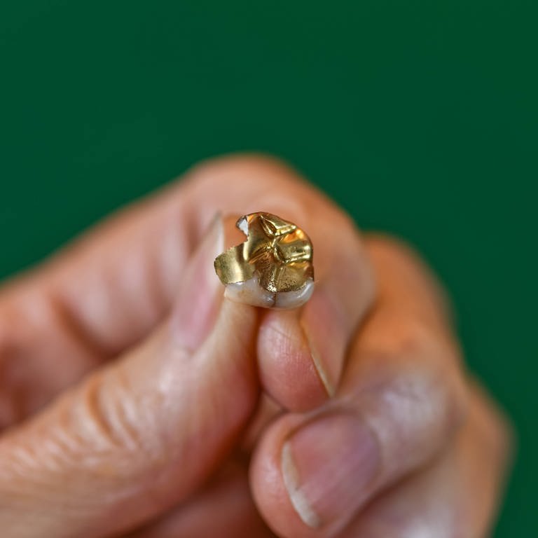 Eine Hand hält einen Goldzahn vor einem grünen Hintergrund. In Günzburg haben Betrüger in einer Zahnarztpraxis Zahngold im Wert von rund 700 Euro erbeutet.  (Foto: IMAGO, Joko)
