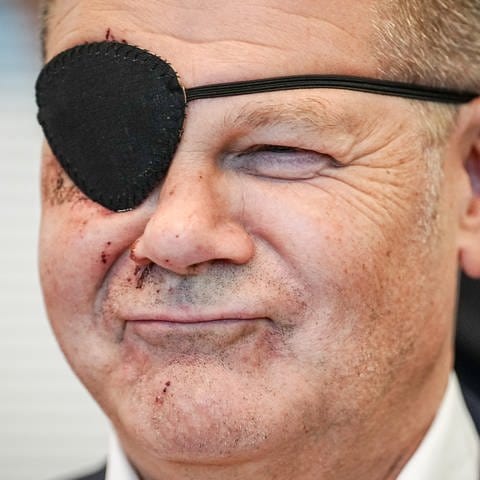 Bundeskanzler Scholz mit Augenklappe