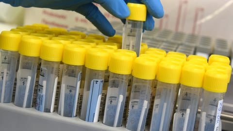 Coronaproben in einem PCR-Labor: Auch im Herbst 2023 ist Corona mit neuen Symptomen, Varianten, Booster-Impfung und steigenden Fallzahlen ein Thema. (Foto: dpa Bildfunk, picture alliance/dpa/dpa-Zentralbild | Waltraud Grubitzsch)