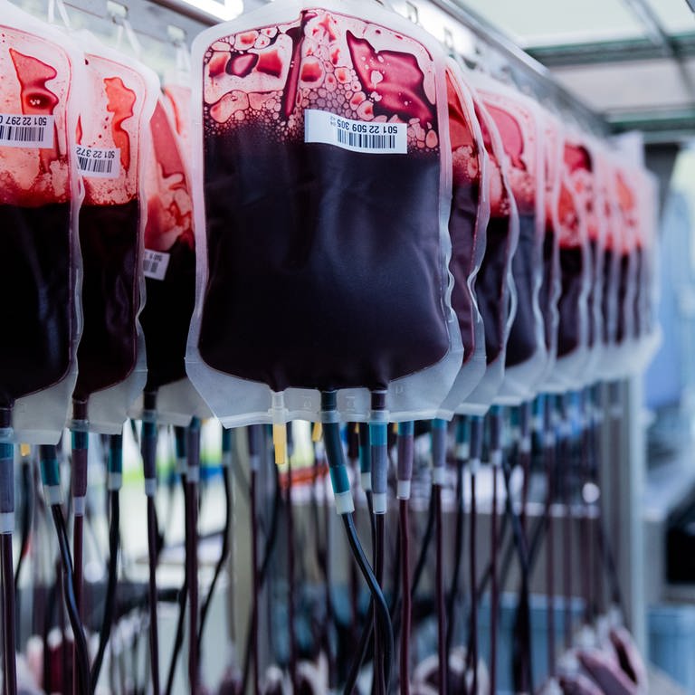 Auf dem Bild sind Blutreserven nach dem Blutspenden zu sehen. 