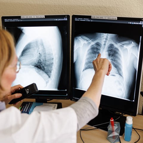 Symbolbild: Eine Radiologin analysiert in ihrem Büro in der Lungenklinik Gauting die Röntgenbilder der Lunge einer aus der Ukraine geflüchteten Person. (Foto: dpa Bildfunk, picture alliance/dpa | Matthias Balk)