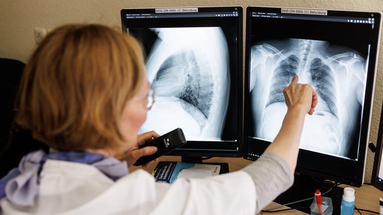 Symbolbild: Eine Radiologin analysiert in ihrem Büro in der Lungenklinik Gauting die Röntgenbilder der Lunge einer aus der Ukraine geflüchteten Person. (Foto: dpa Bildfunk, picture alliance/dpa | Matthias Balk)