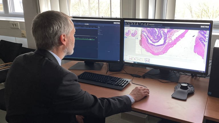 Professor Wilfried Roth​, Direktor des Instituts für Pathologie an der Unimedizin Mainz, mit der digitalisierten Schnittaufnahme eines Darmtumors (Foto: SWR)