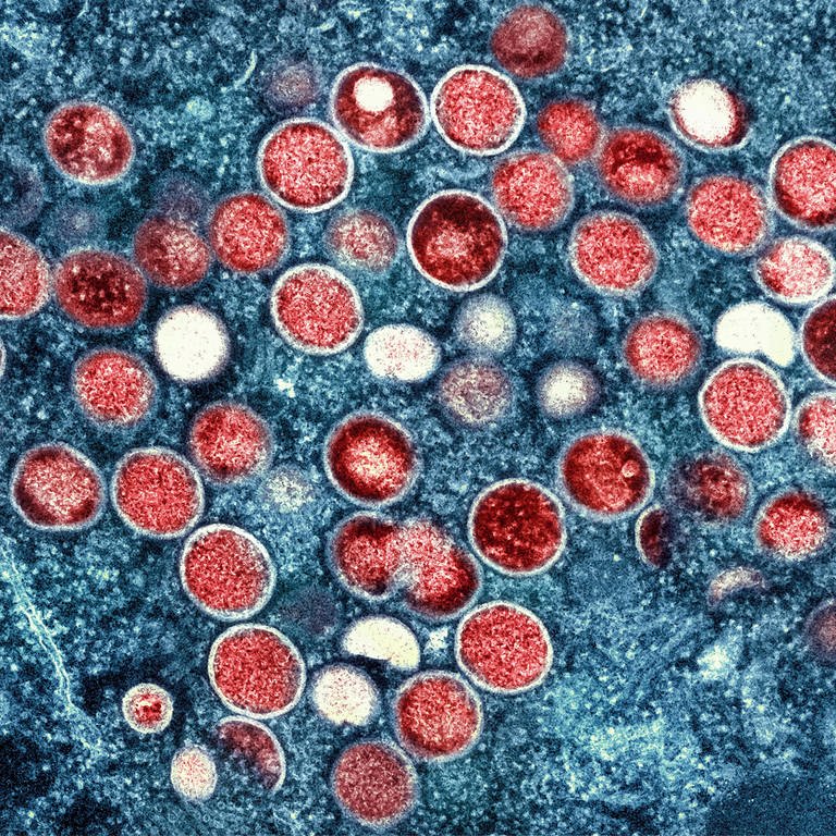 Partikel des Affenpocken-Virus unter dem Mikroskop.