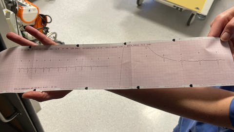 Station 22 - Arbeit auf der Intensivstation des Klinikums Idar-Oberstein - EKG Bild vor und nach einer Kardioversion. (Foto: SWR)