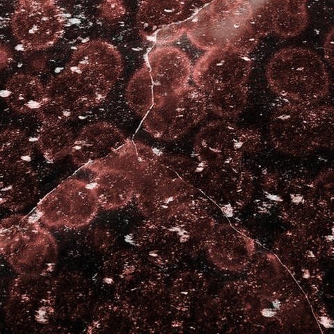 Blut unterm Mikroskop (Foto: Colourbox, Zhukovskyi Serhii/Montage BR)