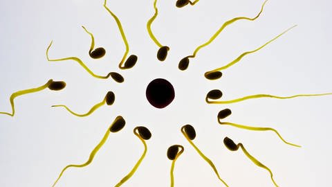 Spermien auf dem Weg zur Eizelle (Foto: Pixabay License -Freie kommerzielle Nutzung )