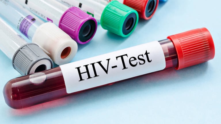 Probenentnahmeröhrchen mit HIV-Testetikett im Labor (Foto: IMAGO, IMAGO / agefotostock)