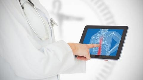 Ein Arzt hält einen Tablet-PC in der Hand und zeigt auf eine Computeranimation eines Rückens. (Foto: Getty Images, Thinkstock -)