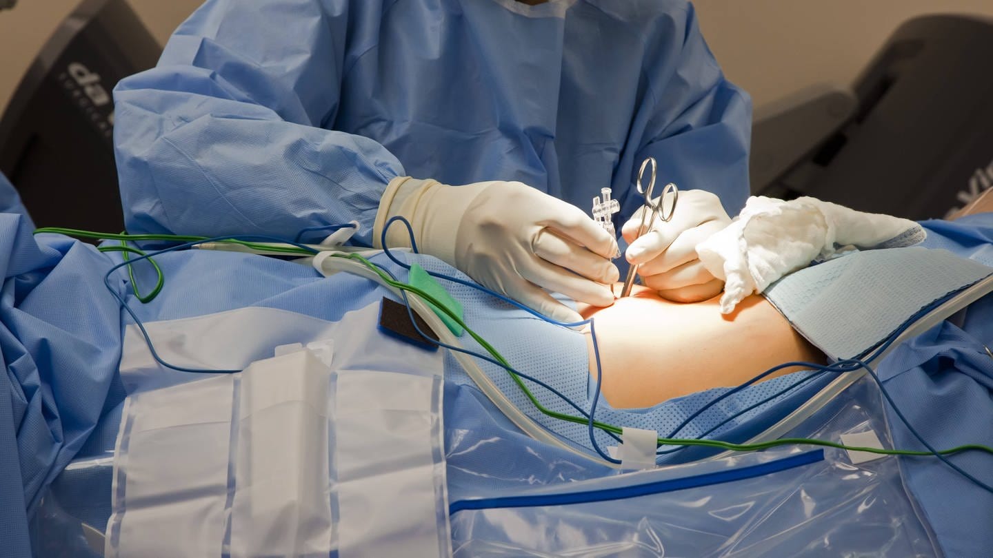Arzt bei der Operation eines Patienten (Foto: IMAGO, imago images / imagebroker)
