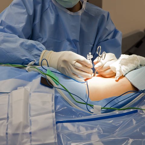 Arzt bei der Operation eines Patienten (Foto: IMAGO, imago images / imagebroker)
