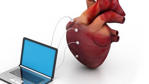 Ein Herz ist an einen Computer angeschlossen (Foto: Colourbox, Foto: Colourbox.de -)