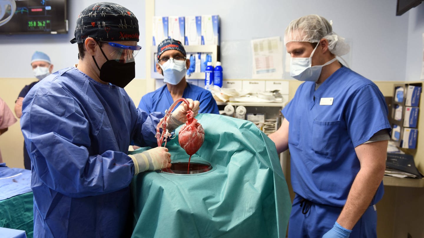 Mitglieder des Operationsteams zeigen im Januar 2022 das Schweineherz, das dem Patienten David Bennett transplantiert werden soll. Das Foto wurde von der Maryland School of Medicine zur Verfügung gestellt. Der Patient starb zwei Monate später. (Foto: IMAGO, IMAGO / ZUMA Press)