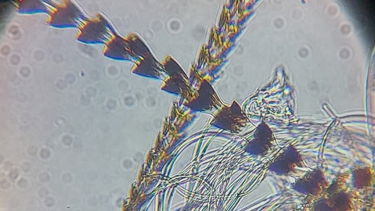 Fledermaushaare unter dem Mikroskop (Foto: SWR, Lukas Meyer-Blankenburg)