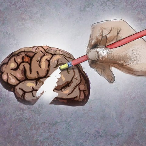 Zeichnung: Große Hand löscht mit einem Stift einen Teil des Gehirns (Foto: IMAGO, IMAGO / Ikon Images)