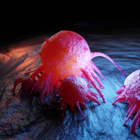 Darstellung von Krebszellen die den menschlichen Körper angreifen (Foto: IMAGO, IMAGO / Westend61)